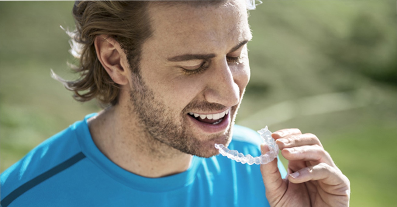 Smile transformation made easy: Understanding Invisalign treatment and its advantages